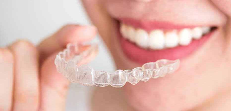 Mouthguard Dentist