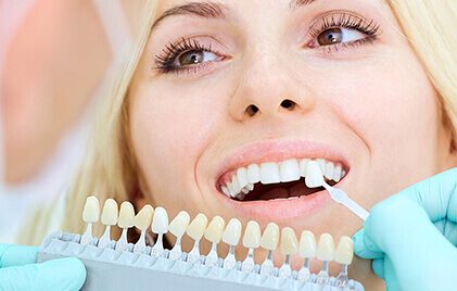 Dental Veneers